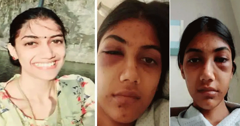 woman attacked | bignewskerala